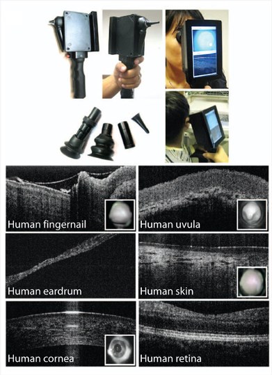 Smartphone-based imaging systems.