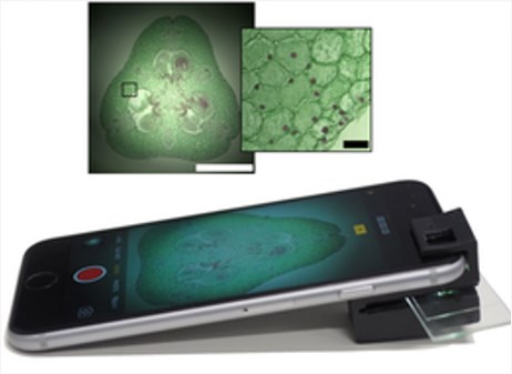 Smartphone attachment for brightfield microscopy.