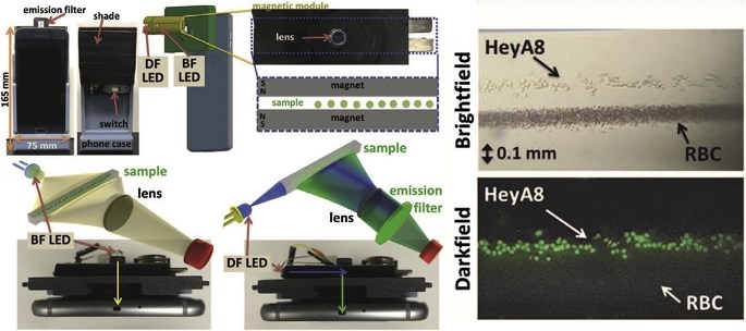 Smartphone cytometry using magnetic levitation and fluorescence microscopy for counting and separation of tumor cells.