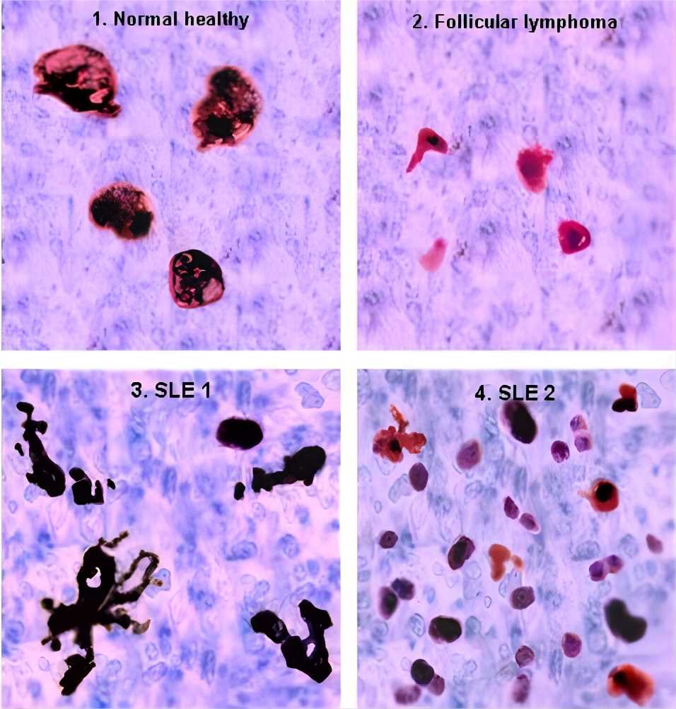Germinal centres of SLE patients and controls.