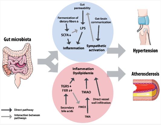 Summary of the effects of gut microbiota on atherosclerosis.