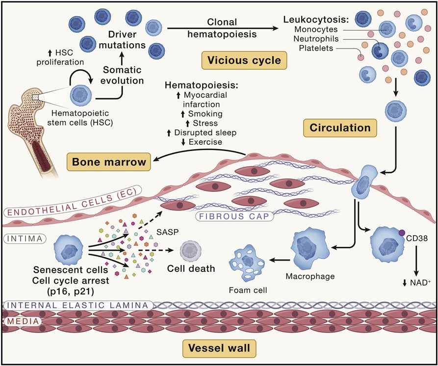 Mechanism of interaction between aging and atherosclerosis.