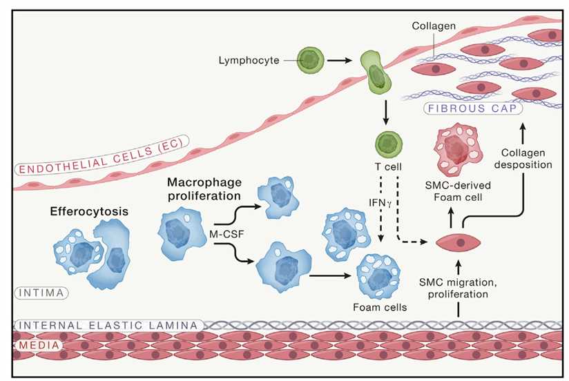 Fig.3 Recent progress in atherosclerosis study. (Björkegren, et al., 2022)