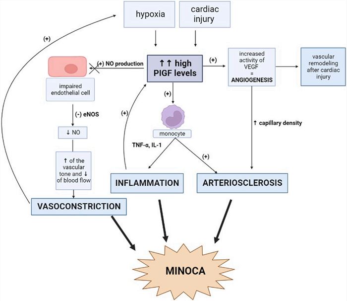 The PIGF function in relation to on-obstructive coronary arteries (MINOCA).