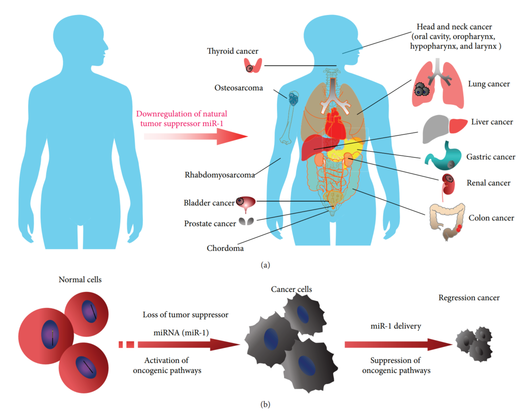 Fig.3 miR-1 expression in human malignancies. (Lüke, et al., 2016)