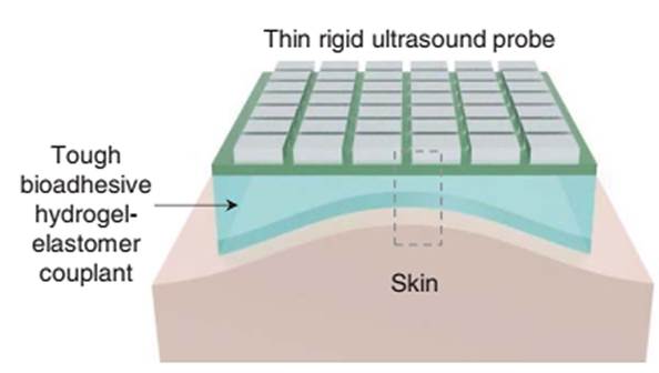 A Novel Bioadhesive Ultrasound Strategy for Organ Imaging