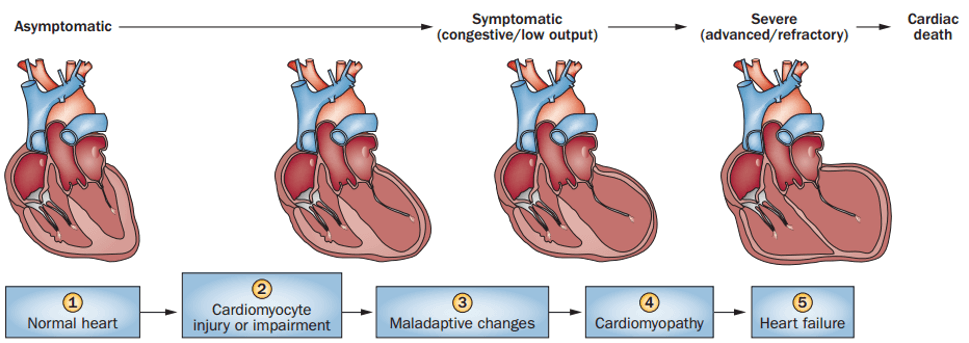 Stages in the course of paediatric ventricular dysfunction.