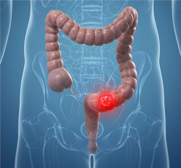 Biomarkers and Antibodies Development for Colorectal Cancer