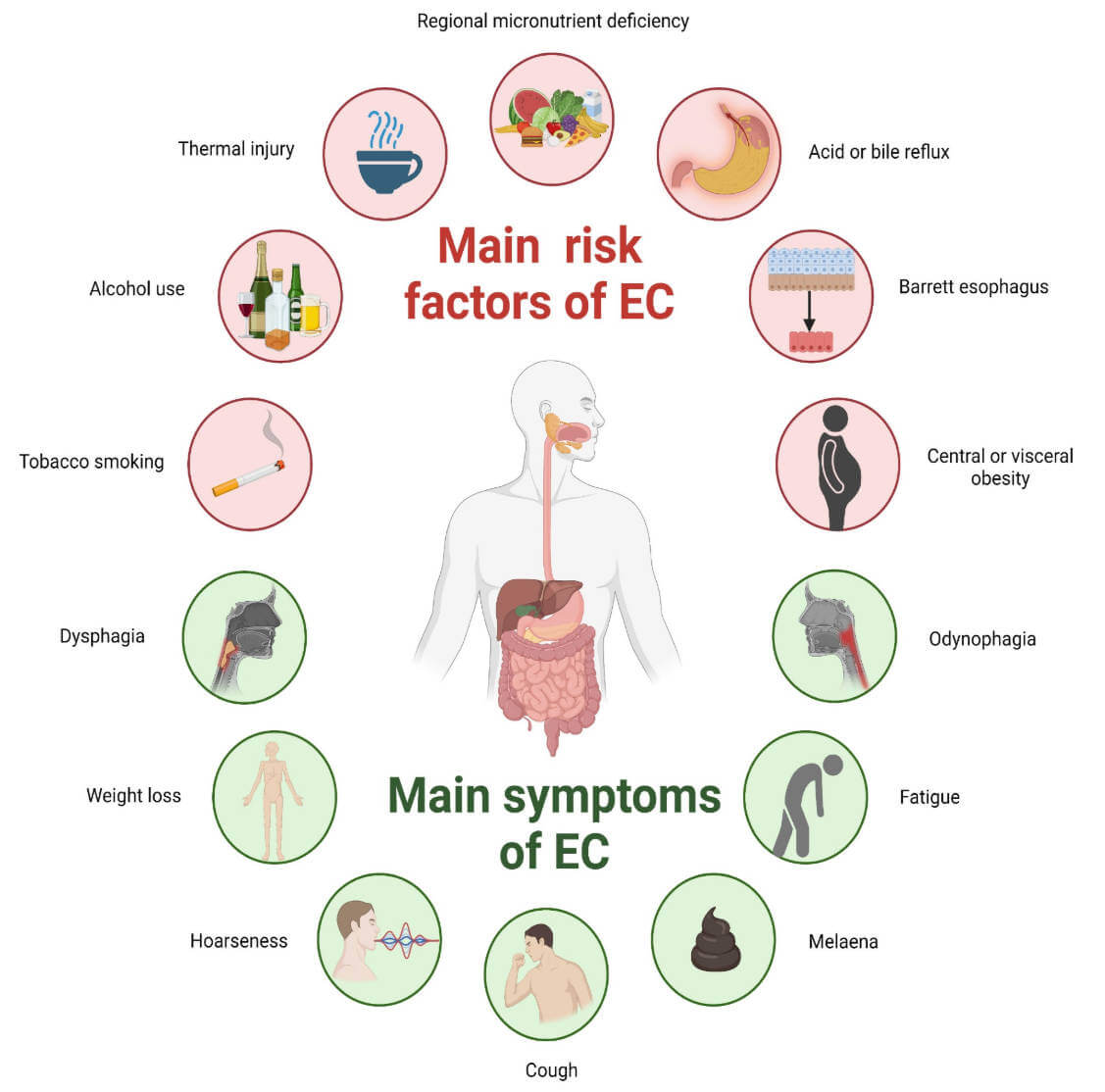 An overview of main risk factors, symptoms of esophageal cancer.