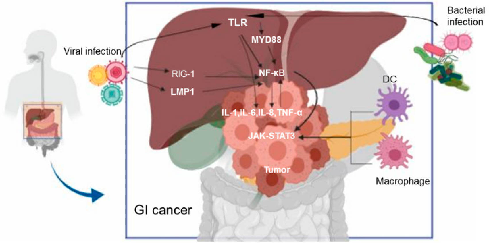 An overview of the mechanisms by which pathogens induce gastrointestinal cancer.