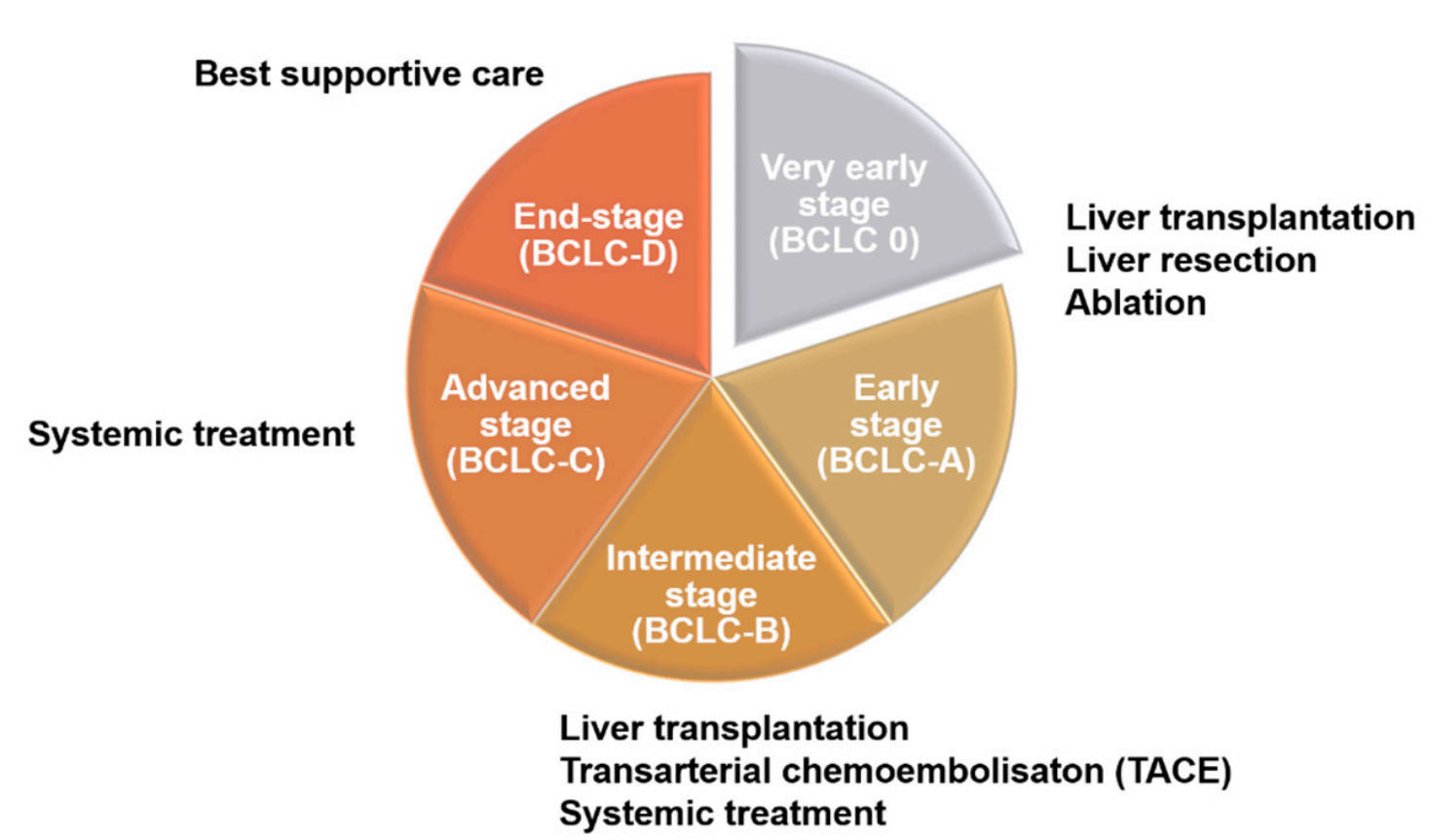 A summary of treatment strategies for liver cancer at different stages.