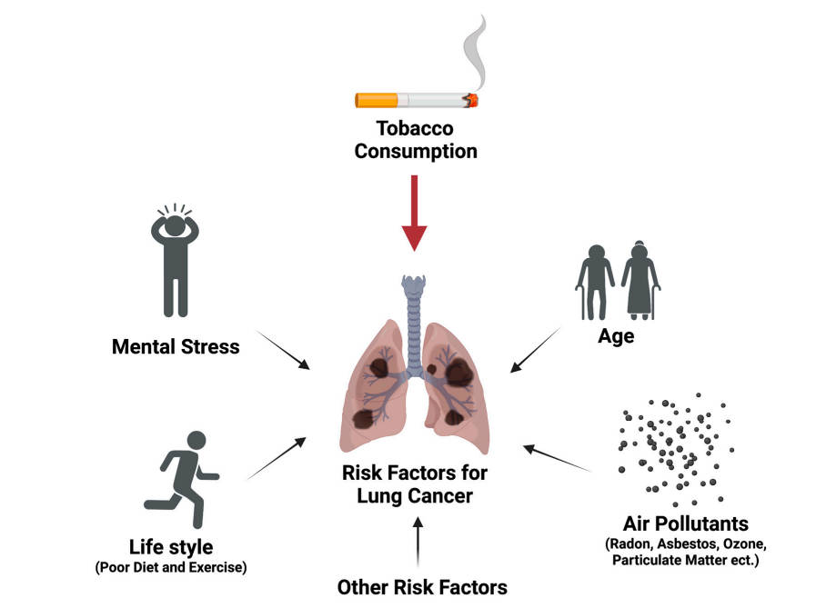 A summary of risk factors for lung cancer development.