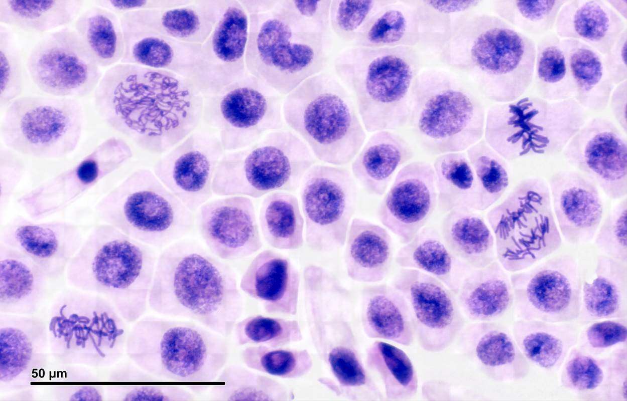 Root meristem of onion cells in prophase.