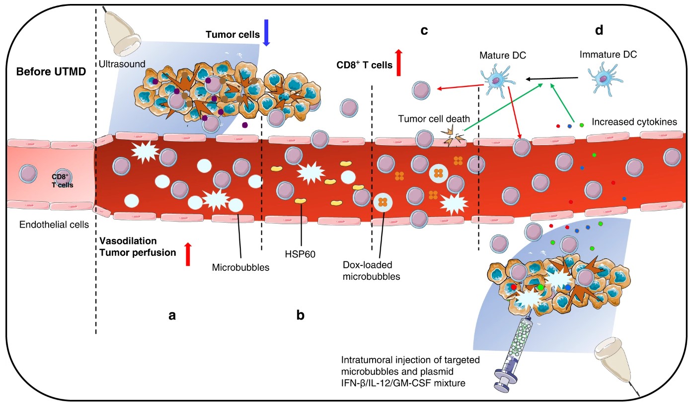 Enhancing immunotherapy via ultrasound-targeted microbubble destruction for TME remodeling.