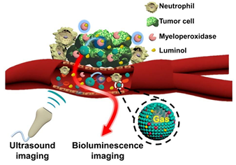 Bioluminescence Imaging of Inflammation by decorated nanobubble.