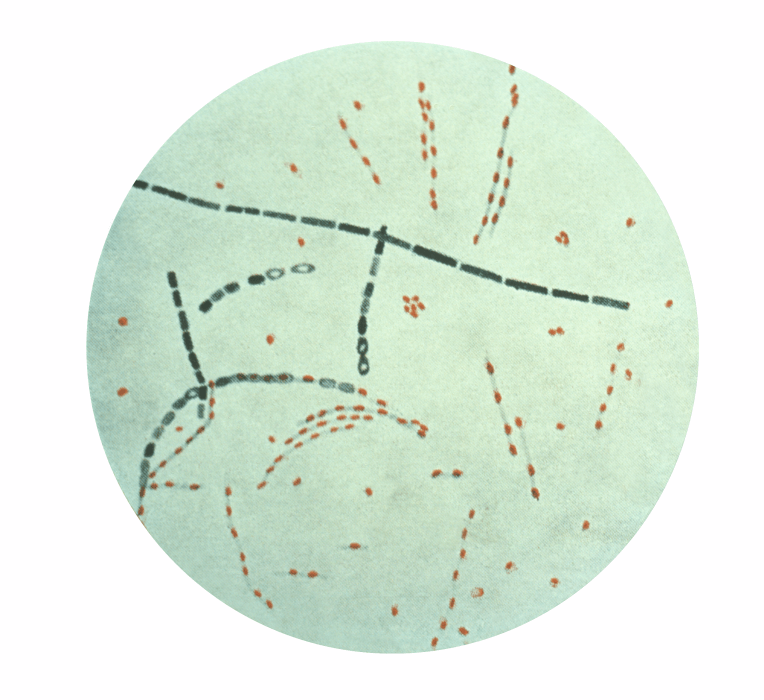 Fig.2 The morphology of Bacillus anthracis. (https://commons.wikimedia.org/wiki/File:Bacillus_anthracis.png)