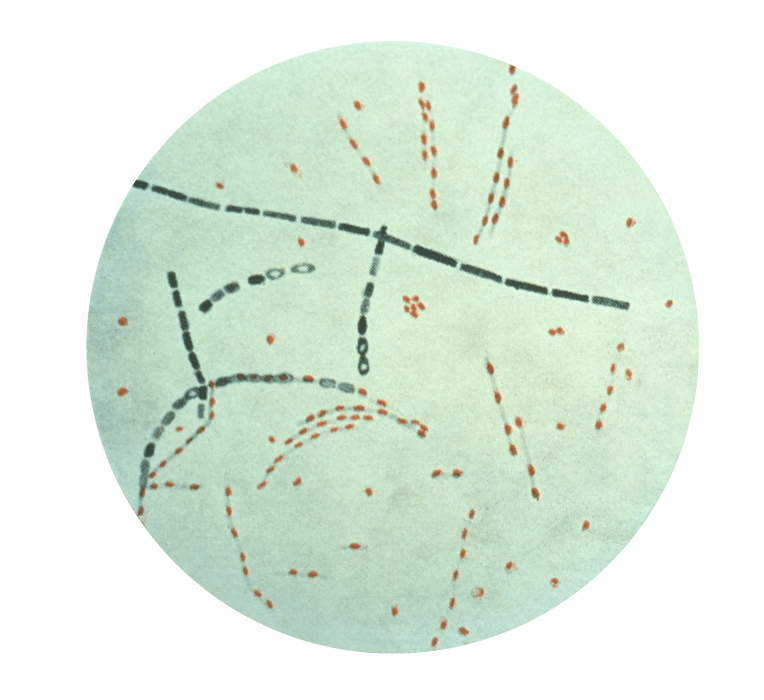 Photomicrograph of Bacillus anthracis