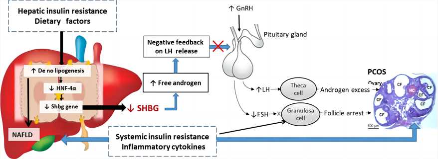 Fig.1 The hypothetical mechanisms associating PCOS onset. (Qu & Donnelly, 2020)
