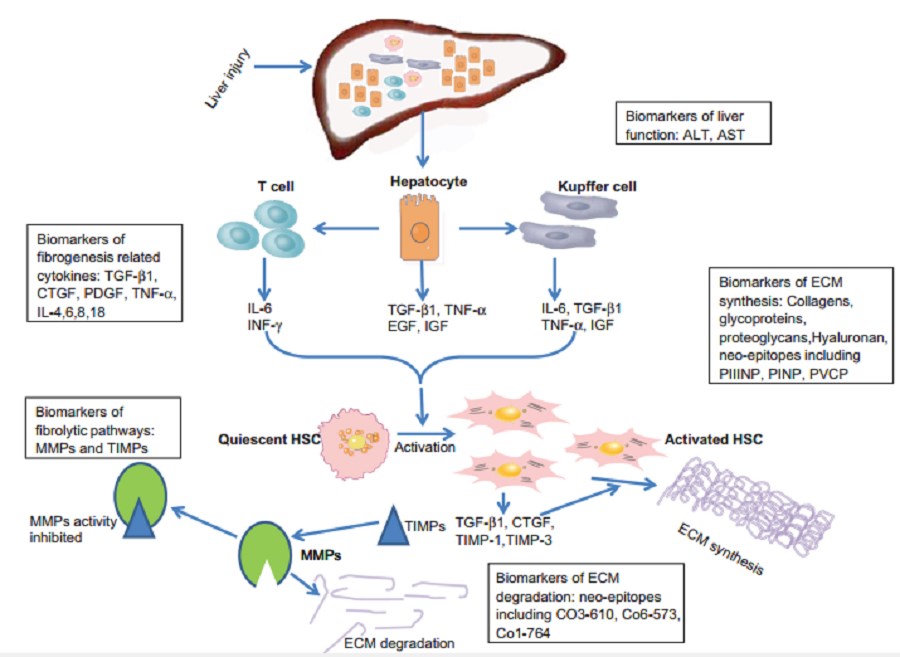 Mechanisms of hepatic fibrogenesis and possible molecular serum biomarkers.