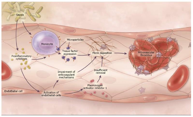 Pathogenesis of disseminated intravascular coagulation in sepsis