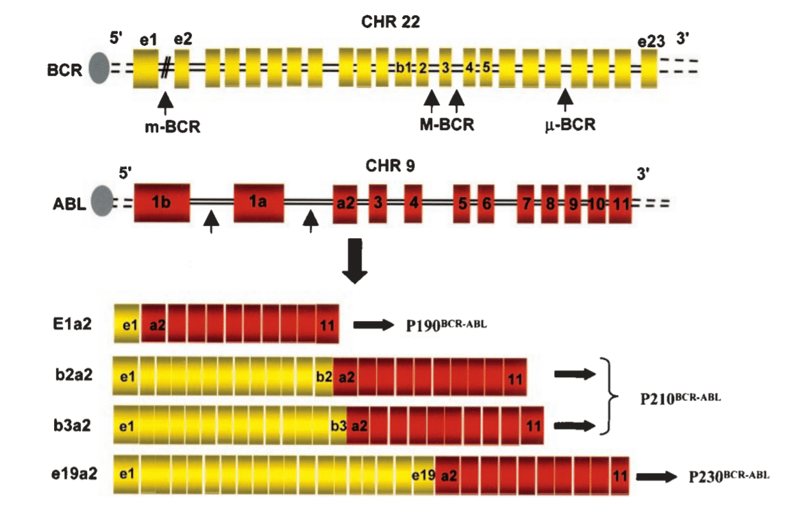 Locations of the breakpoints in the ABL and BCR genes and structure of the chimeric BCR/ABL mRNA transcripts derived from the various breaks.