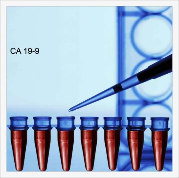 IVD Antibody Development Services for CA19-9 Marker