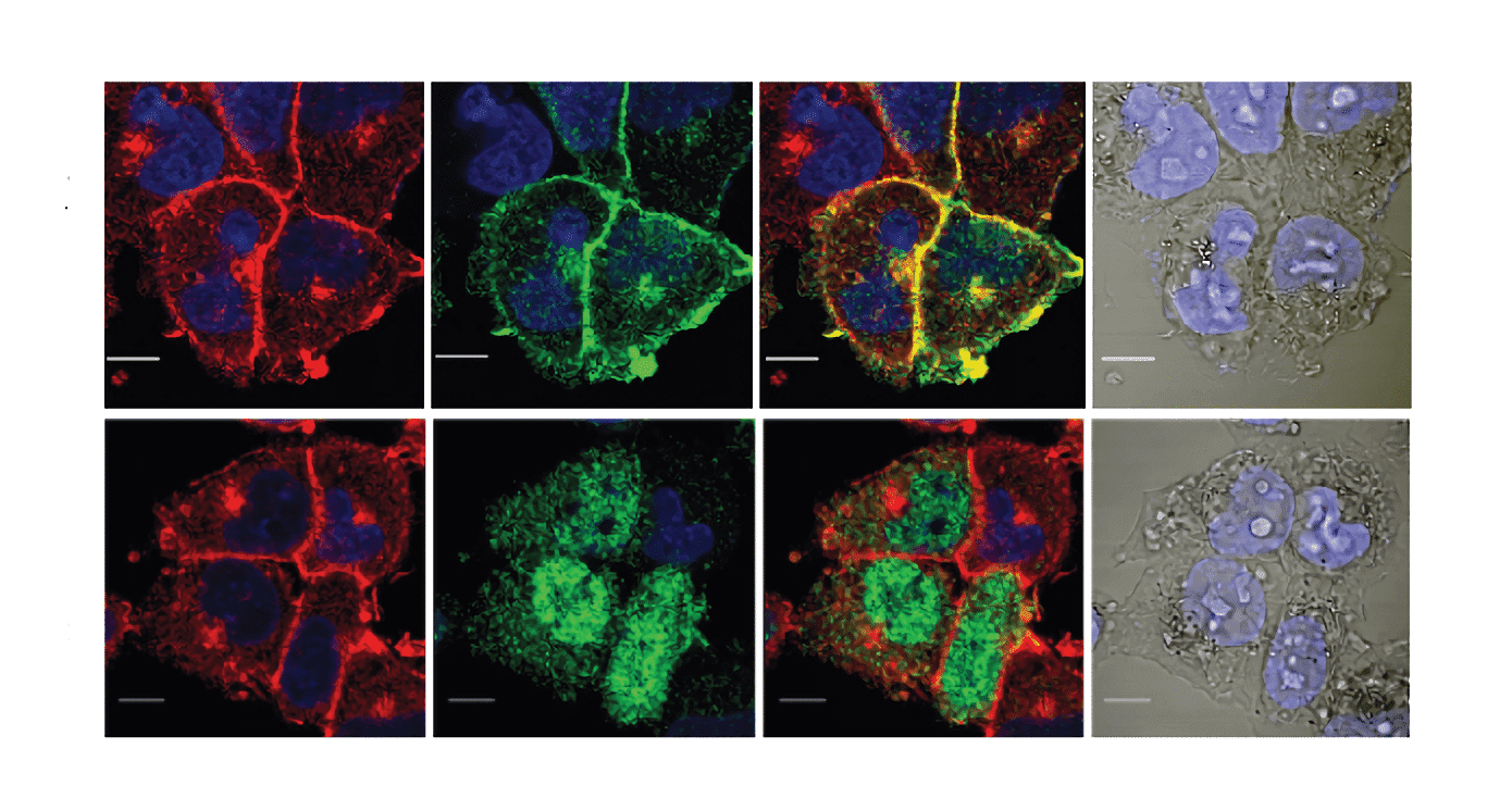 Subcellular localization of CCND1.