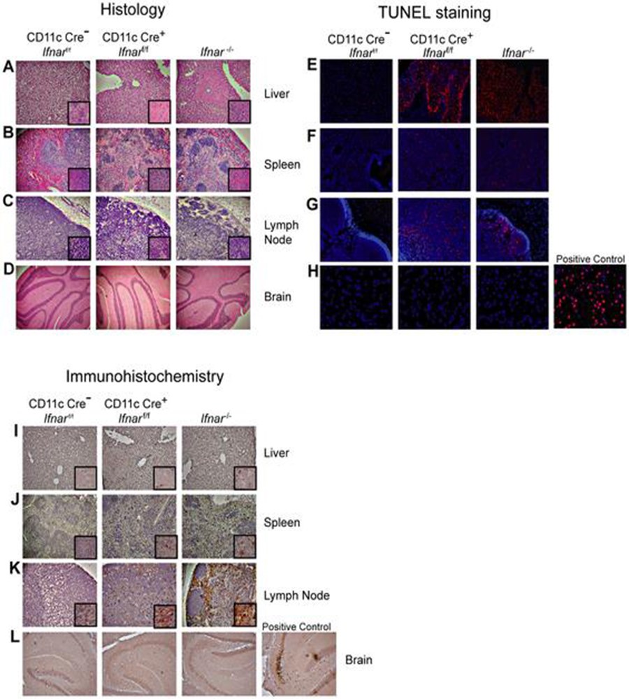 Tissue analysis of WNV infected CD11c Cre+ Ifnarf/f mice.