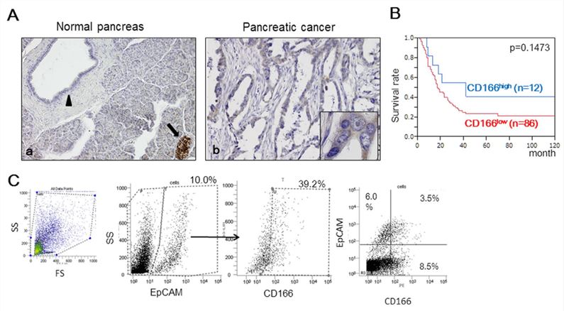 Research data on CD166 expression in human pancreatic tissues.