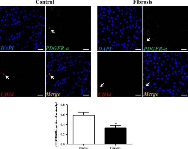 CD34 double-positive telocytes are decreased in liver fibrosis.