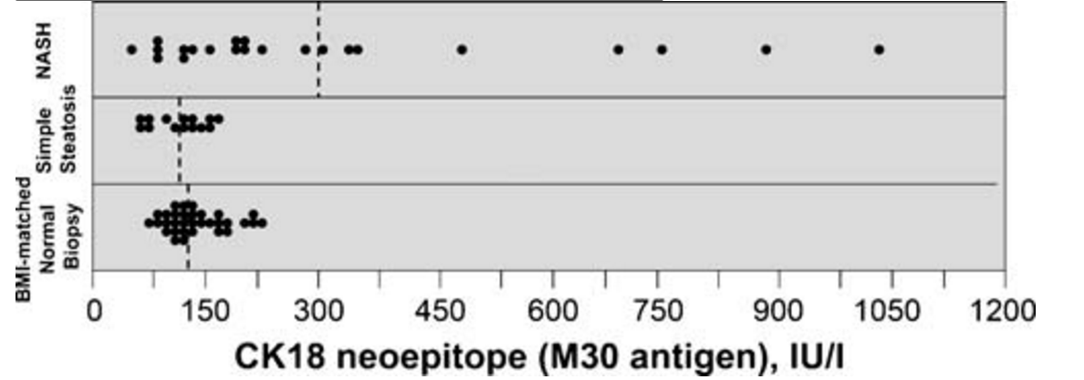 CK-18 neoepitope (M30 antigen) levels are significantly increased in the serum of NASH patients in comparison to patients with SS and controls.