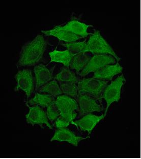 A microphotograph of Cytokeratin 8 staining in the human breast cancer cell line MCF-7.