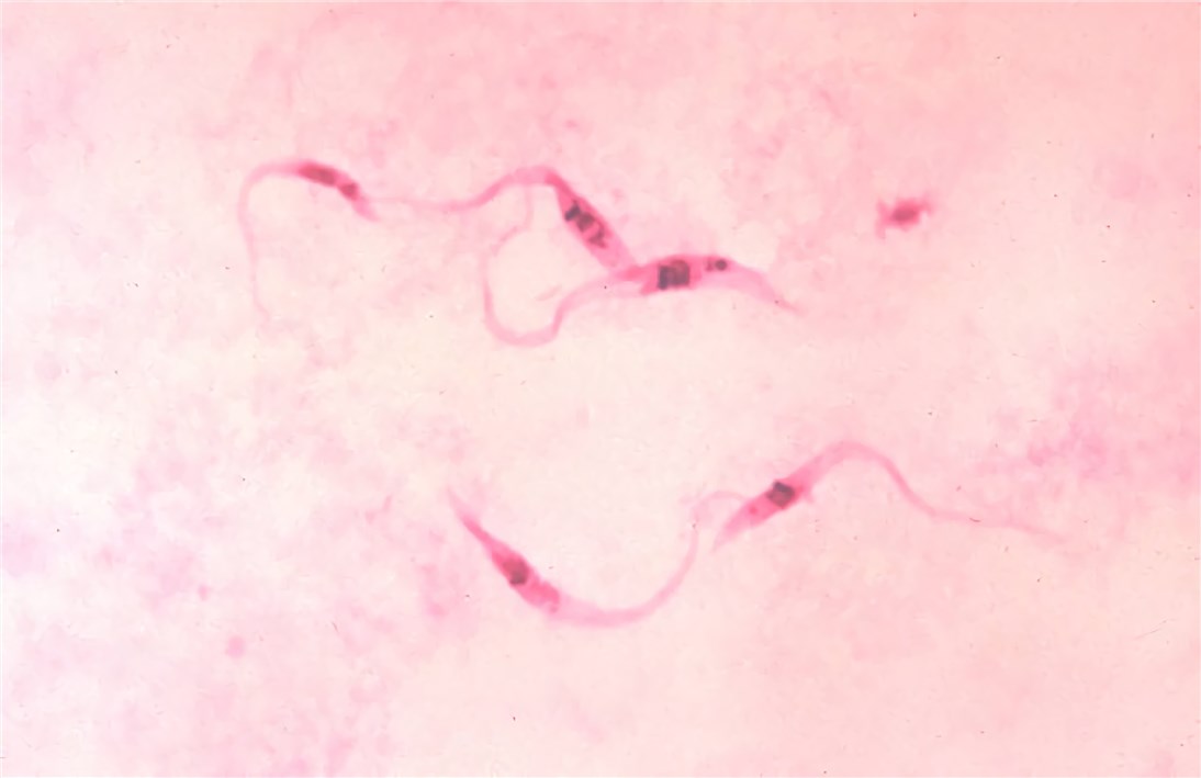 Fig.2 T. cruzi morphology. (https://commons.wikimedia.org/wiki/File:Trypanosoma_cruzi_crithidia.jpeg)