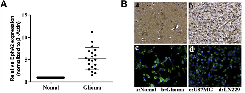 The expression of EphA2 in glioma. (A) Real-time PCR analysis of EphA2 expression in glioma and normal tissues; (B) IHC images of EphA2 expression level in glioma tissues and glioma cell lines U87MG, LN229 cells.