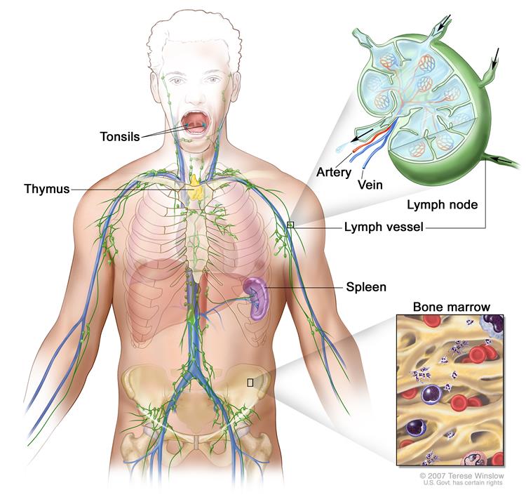 Anatomy of the lymph system, showing the lymph vessels and lymph organs including lymph nodes, tonsils, thymus, spleen, and bone marrow.