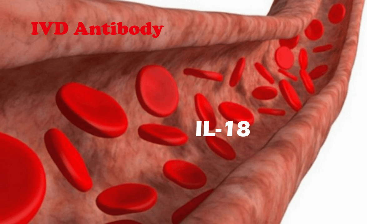 IVD Antibody Development Services for IL-18 Marker