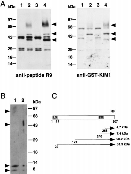 Fig.1 KIM-1 expression in injured kidney revealed. (Ichimura, et al., 1998)