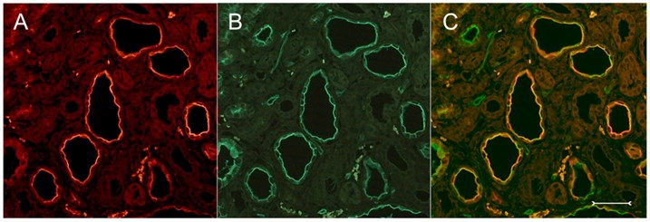 Double fluorescent labeling with anti-Kim-1.