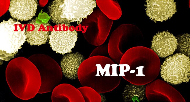 IVD Antibody Development Services for MIP-1 Marker