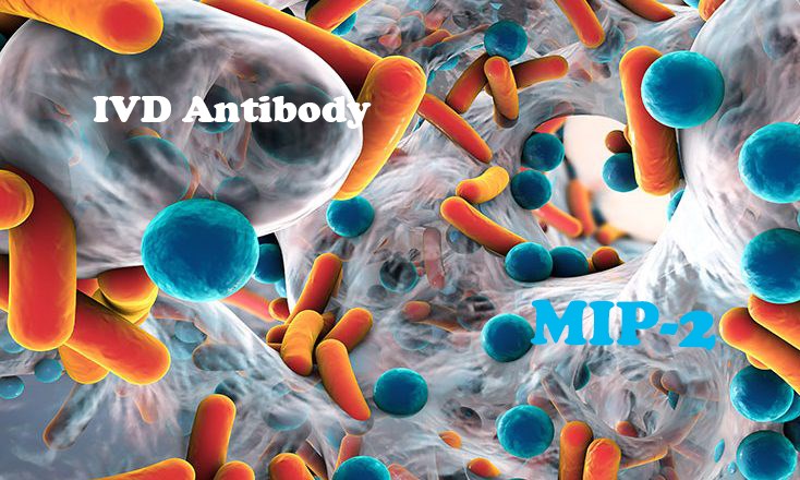 IVD Antibody Development Services for MIP-2 Marker
