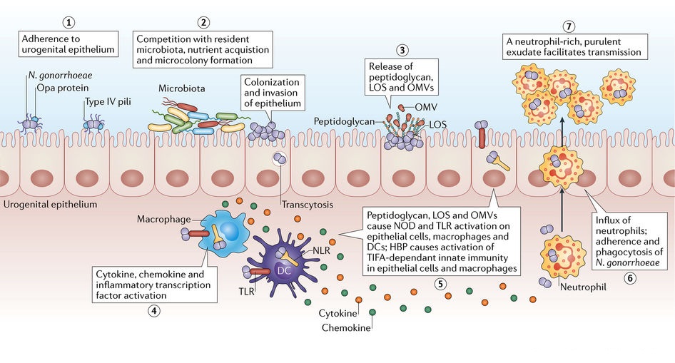 Overview of Neisseria gonorrhoeae infection.