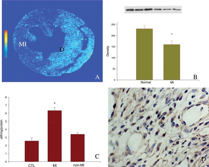 Expression of superoxide dismutase, malondialdehyde, and 3-nitrotyrosine in the infarcted rat heart. Nitrotyrosine is a promising biomarker of MI.
