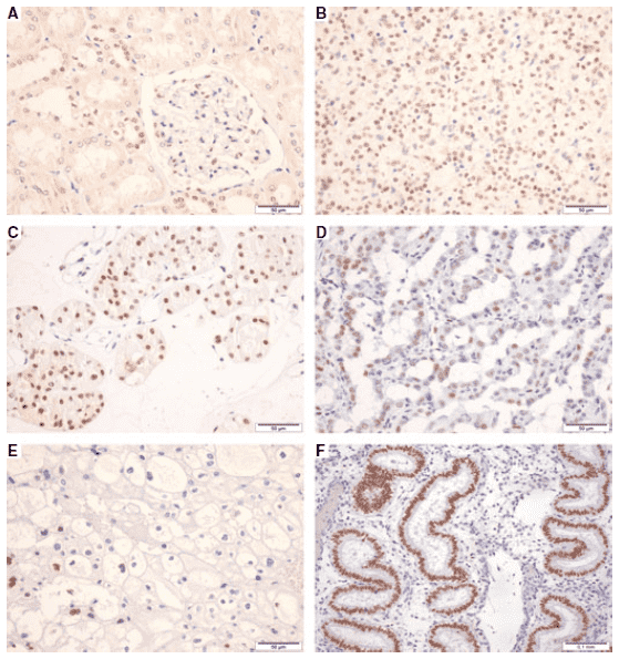 Expression patterns of PAX-2 protein.