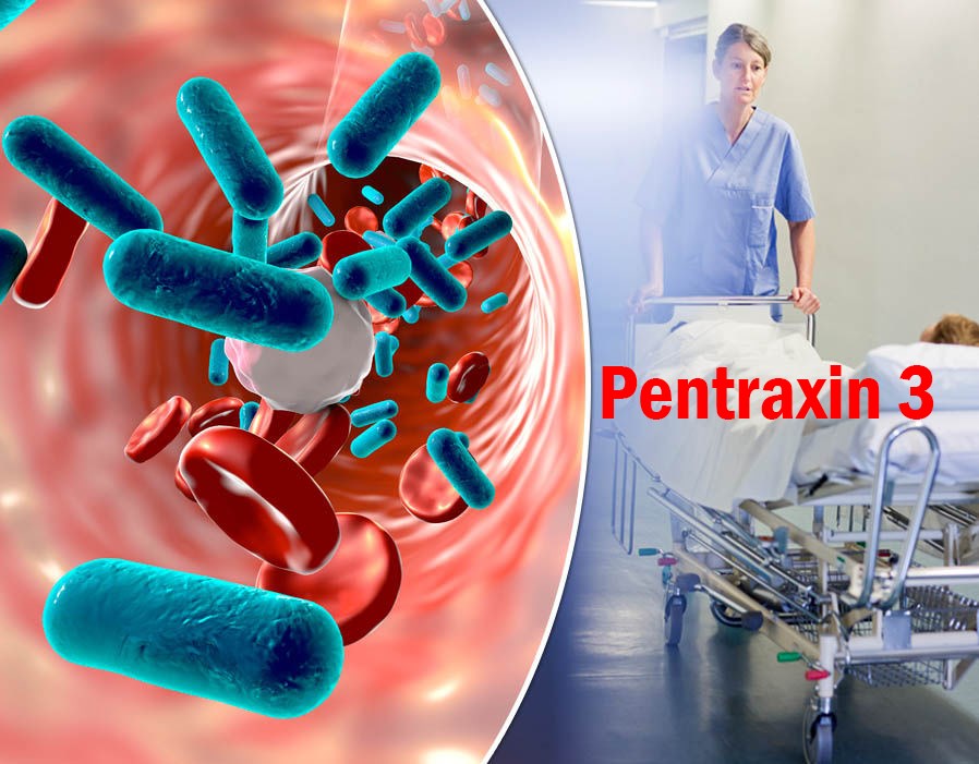 IVD Antibody Development Services for Pentraxin 3 Marker