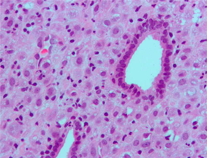 Fig.1 Progesterone-induced changes in the endometrium. (From Wiki: By Nephron - Own work, https://commons.wikimedia.org/wiki/File:Endometrium_ocp_use3.jpg)