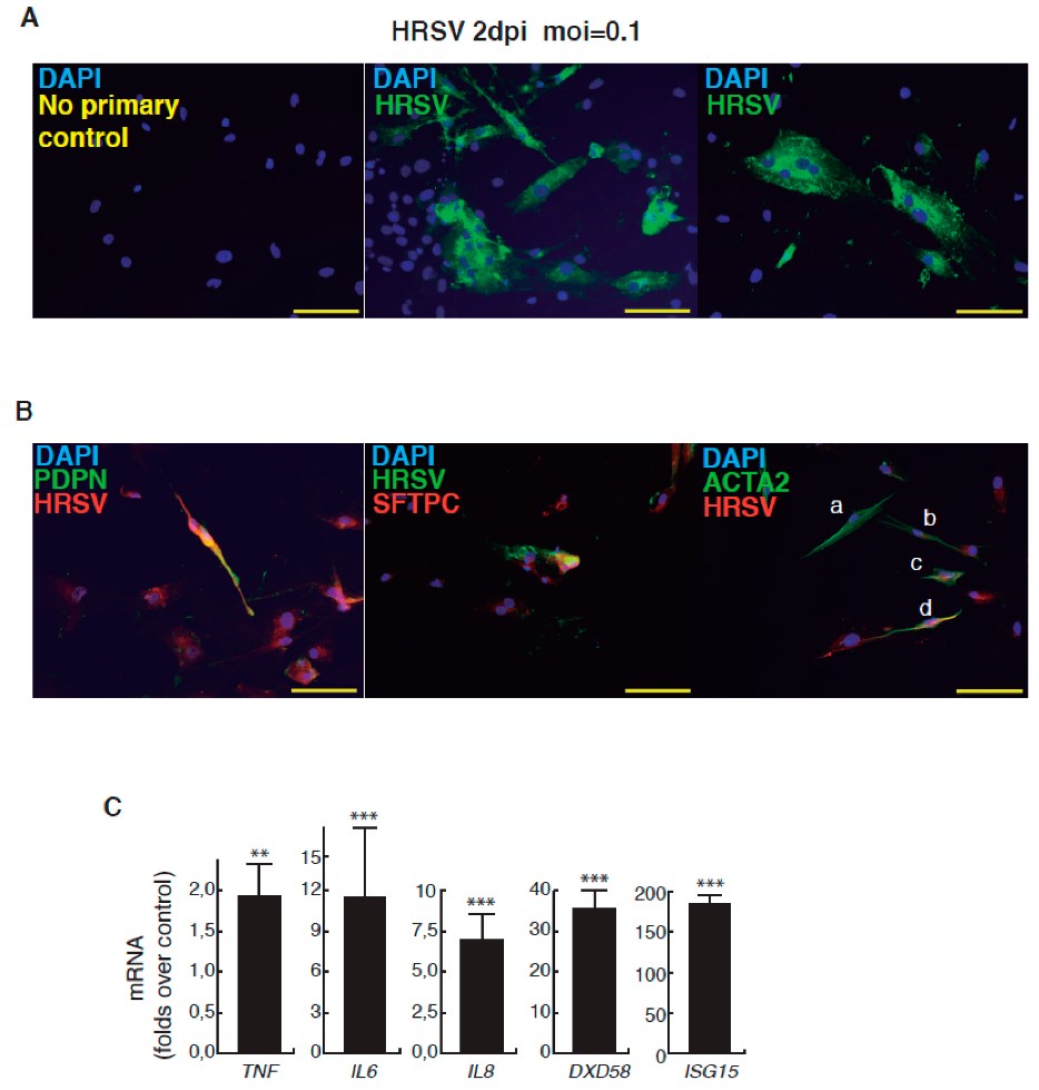Infection of minilungs by HRSV.