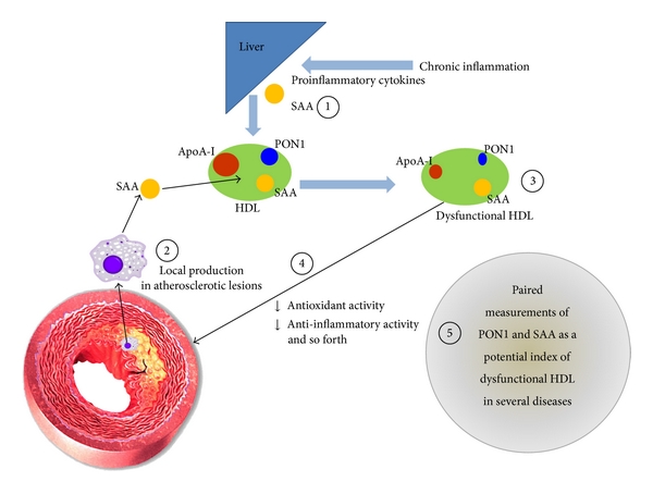 Fig. 1 The interplay between PON1 and SAA in HDL particles. (Kotani, et al., 2013)