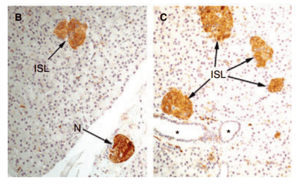 Fig.1 Presence of class III b-tubulin (TUBB3) in the normal human pancreas.
