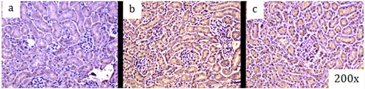 a, b, and c: Immunohistochemistry, brown staining, for 8-0H8dG in kidney before (a), 24 hrs (b) and 48 hrs (c) after S.aureus peritoneal sepsis in mice.