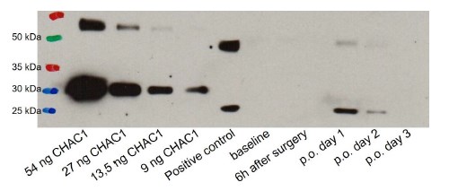 Western blot analysis of urinary Chac1 in the renal ischemia-reperfusion injury